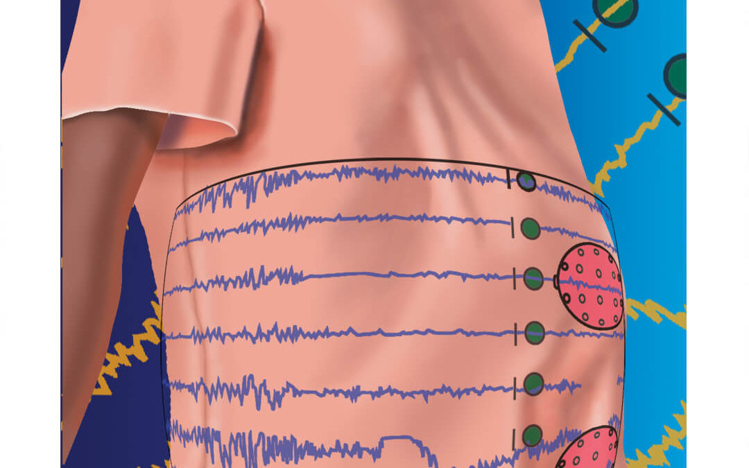 Medical Illustration, Pregnancy & Epilepsy, digital
